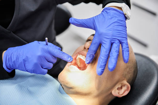 Best Emergency Wisdom Tooth Extraction in Moon Lake, FL